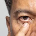 3 Types of Cataract Surgery Available