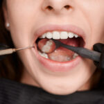 Understanding the Different Types of Dental Fillings