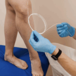 What To Look for in a Quality Vascular Specialist