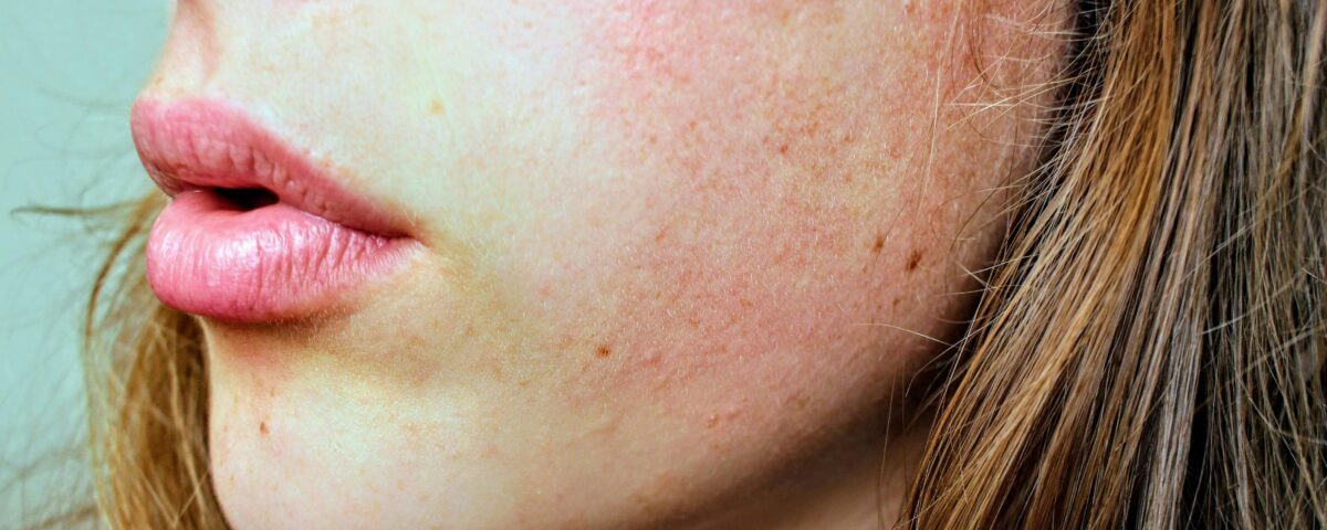 When Should I See a Dermatologist About Dry Skin?