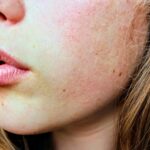 When Should I See a Dermatologist About Dry Skin?