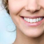 How Veneers Can Transform Your Smile