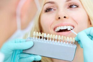 How Veneers Can Transform Your Smile
