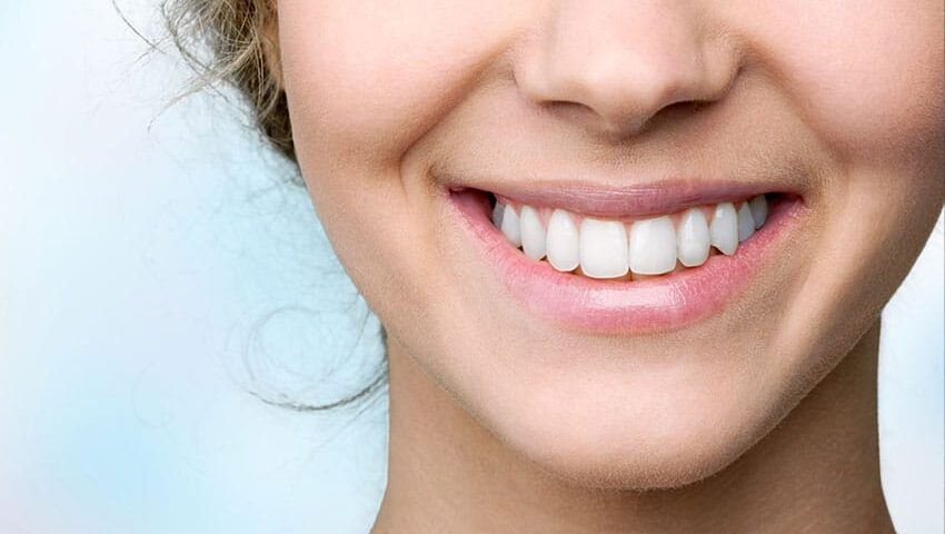 How Veneers Can Transform Your Smile
