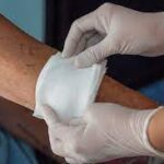 Practical Tips for Caring for Surgical Wounds at Home