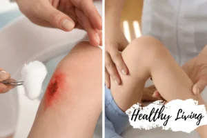 Practical Tips for Caring for Surgical Wounds at Home