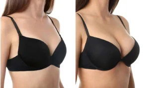 When to Consider Getting a Breast Lift